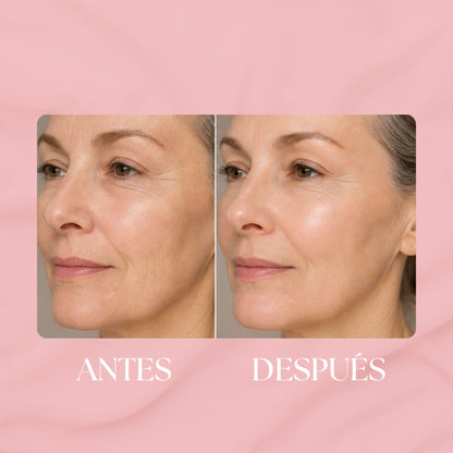 1+1 GRATIS | Bálsamo de Colágeno antiarrugas para una piel firme y luminosa